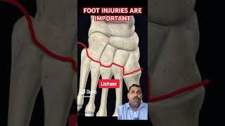 Foot injury