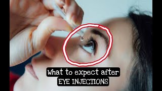 What to expect after EYE INJECTION? #eyeinjection #maculardegeneration