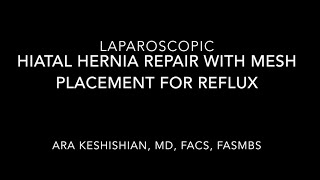 Laparoscopic Hiatal Hernia with Mesh Placement