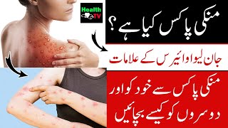 What is Monkeypox Virus M Pox and its Symptoms | How to avoid Monkeypox | Urdu Hindi | Health TV