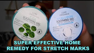 EFFECTIVE STRETCH MARK HOME TREATMENT