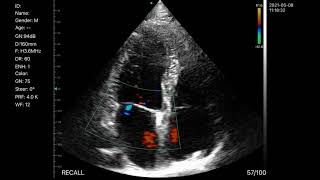 KONTED C10UC phased array wireless/USB ultrasound