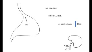 Metabolic Alkalosis November 2020 Blood Gas