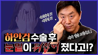 하안검 수술 후 눈 밑이 뒤집어졌다? 안검외반 원인부터 교정 방법 보고 가세요 !  - 의학박사 백승준