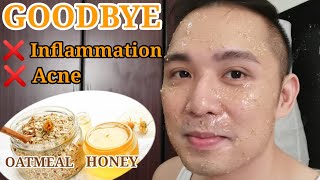 DIY ANTI - INFLAMMATORY & ANTI -ACNE Face Mask || Oatmeal & Honey