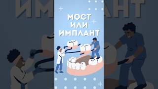 МОСТ ИЛИ ИМПЛАНТ?