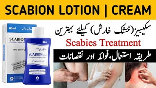 scabion lotion use in urdu | scabion lotion lagane ka tarika |scabion cream |