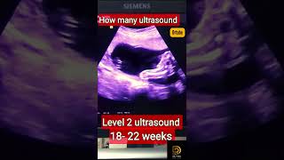 Pregnancy me kab kab ultrasound karwana hai | How many ultrasound required #shortsfeed #drtube