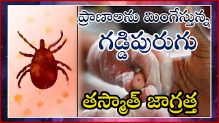 scrub typhus disease telugu | ప్రాణాలను మింగేస్తున్న గడ్డి పురుగు