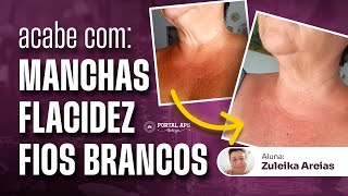 Redução de MANCHAS, FLACIDEZ E FIOS BRANCOS usando óleos essenciais