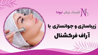 زيباسازی و جوانسازی با آر اف فرکشنال | کلینیک زیبایی نیوشا