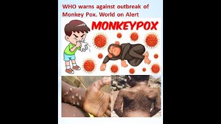 WHO  warns  against outbreak  of Monkey Pox. World  on Alert  #MonkeyPox#viral