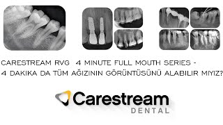 Carestream RVG  4 Minute Full Mouth Series - 4 dakika da tüm ağızının görüntüsünü alabilir miyiz?