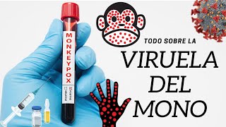 MPOX ¿NUEVA PANDEMIA?