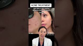 Check out this GREAT acne treatment! #skincare #beverlyhillsplasticsurgery