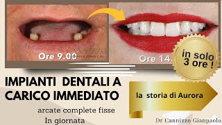 Un caso complesso di implantologia dentale - Studio Dentistico Cannizzo