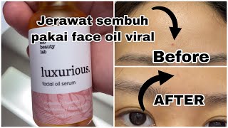 REVIEW LUXURIOUS FACIAL OIL SERUM BIO BEAUTY LAB UNTUK KULIT BERMINYAK&BERJERAWAT