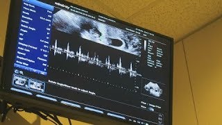 OUR BABY'S HEARTBEAT! 11 WEEKS PREGNANT