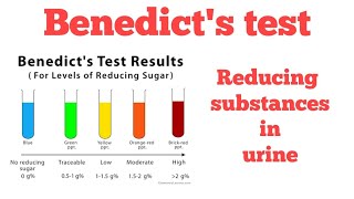 Benedict's test || Reducing substances in urine ||#Biochemistry