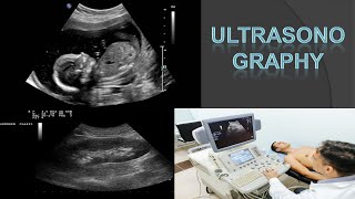 Ultrasonography