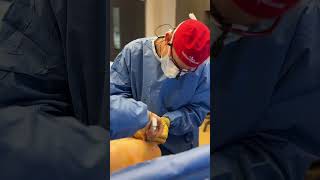 Step into the OR with Doc as he performs a breast augmentation with mastopexy! 💕