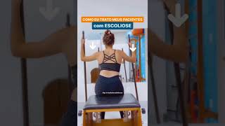 Como eu trato meus pacientes com ESCOLIOSE #escoliose  #fisioterapia #colunavertebral