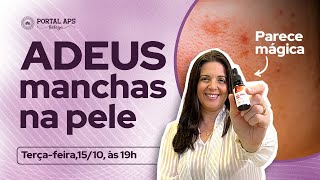 Use para CLAREAR qualquer MANCHA de PELE. Óleo essencial para mancha na pele