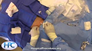 Ultrasound Guided Femoral Arterial Line