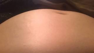 Fetal movement 25 weeks