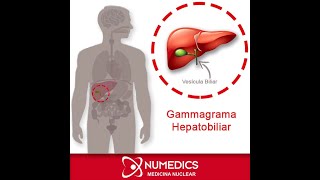 Gammagrama Hepatobiliar