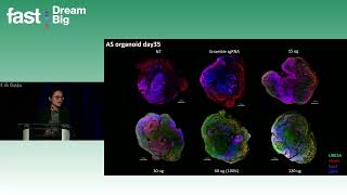 Xiaona Lu (iPSC Biorepository) | 2024 FAST Global Summit on Angelman Syndrome