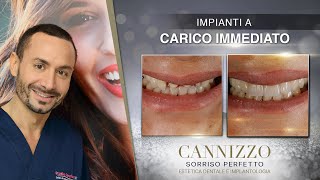 Impianti Dentali e Corone in Ceramica - Dr. Cannizzo