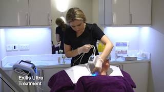 True Medispa - Exilis Ultra Skin Rejuvenation