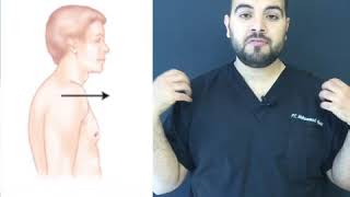 Rounded shoulder exercise....تمارين التفاف الأكتاف للأمام