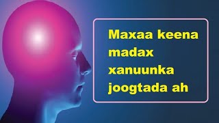 Madax xanuunka noocyadiisa iyo dawayntiisa iyo talooyinkale dr musa Abdirahman