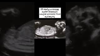 20 ആഴ്ച പ്രായമുള്ള കുഞ്ഞ് amniotic fluid കുടിക്കുന്നത് കണ്ടോ..?#malayalam #pregnancy #taalibeeshome