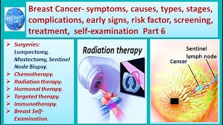 Breast Cancer  symptoms, causes, types, complications, stages,risk factor, treatment 6