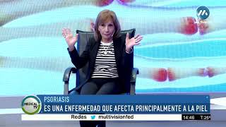 Psoriasis. Medical TV