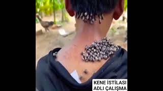 Kene İstilası adlı çalışma #keşfet #viral #başarı #yasincengizdance #haberler #yasincengiz #ayt