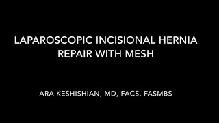 Laparoscopic Incisional Hernia Repair With Mesh