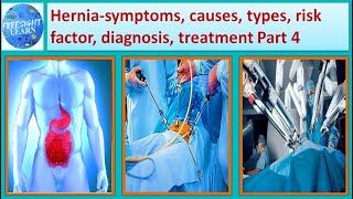 Hernia Symptoms, causes, types, Risk factor, diagnosis, treatment Part 4