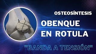 Osteosíntesis  - Obenque en rotula "Banda a tensión"