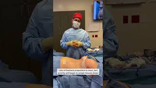 Patient Journey: Fit Patient Has Loose Skin - Body Lift +Tummy Tuck