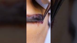 MY EYEBROW TRANSPLANT Experience | Malak