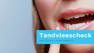 Tandvlees check -hoe gezond is jouw tandvlees?