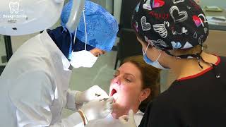 Implant Treatment in Turkey