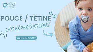 Les répercussions de la succion du pouce ou de la tétine