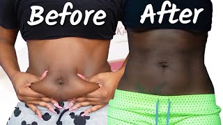 Kabelline Fat Dissolver 3rd Treatment | Before & After