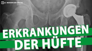 Erkrankungen der Hüfte | Medizinischer Dienstag