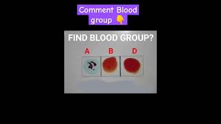 blood group test identify #bloodtypes #blood_test #bloodgroups #trending #viralreels #hematology